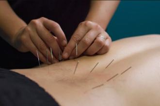 Risks of Dry Needling for Rehabilitation