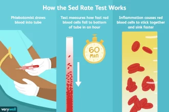 Understanding ESR (Erythrocyte Sedimentation Rate) and Effective Ways to Reduce It