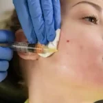 Eradicate Dark Circles