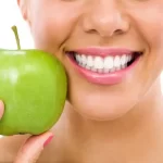 Oral Health and Nutrition
