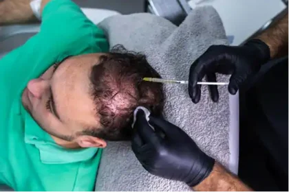 PRP Hair Treatment