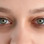 Tired Eyes