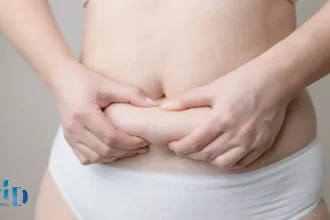 Tummy Tuck