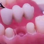 Dental