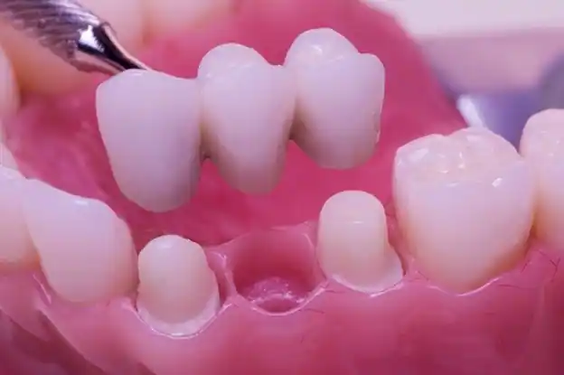 Dental