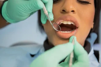dental implants