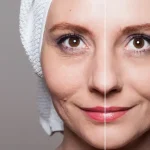 skin rejuvenation clinic