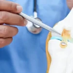 knee replacement costs