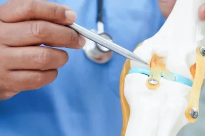 knee replacement costs